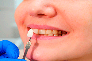 implantes 2