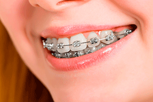 implantes 2