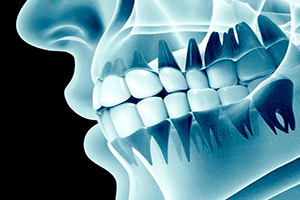 radiologia